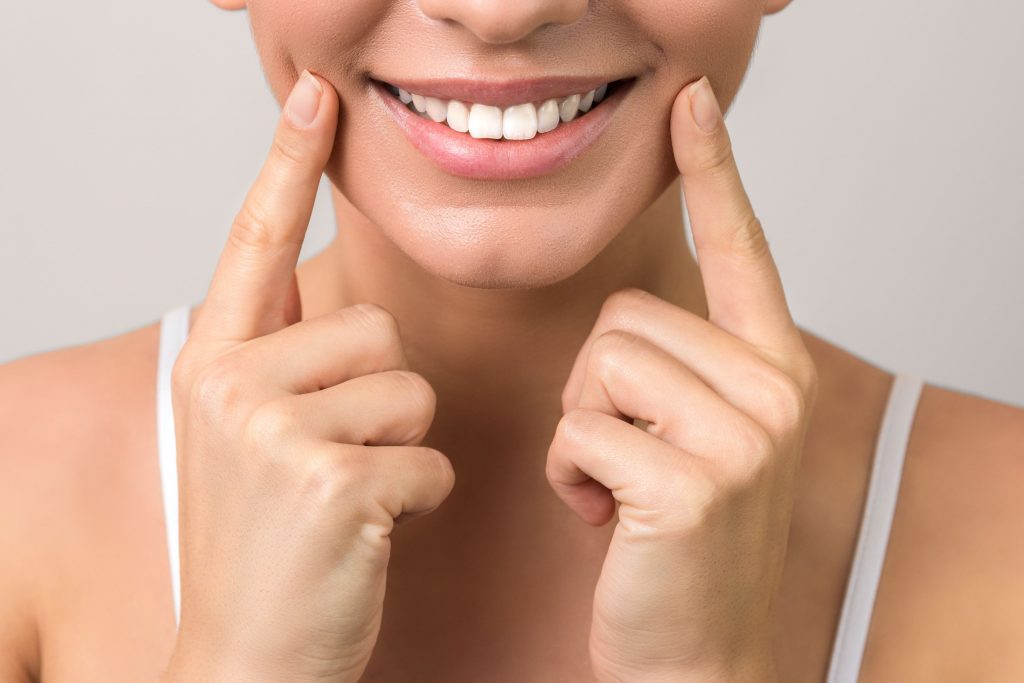 resultado del blanqueamiento dental de la clínica dental Lorenzo Cáceres
