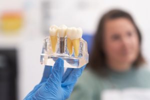 Dr. Lorenzo Cáceres explicando el tratamiento de implantes dentales a una paciente